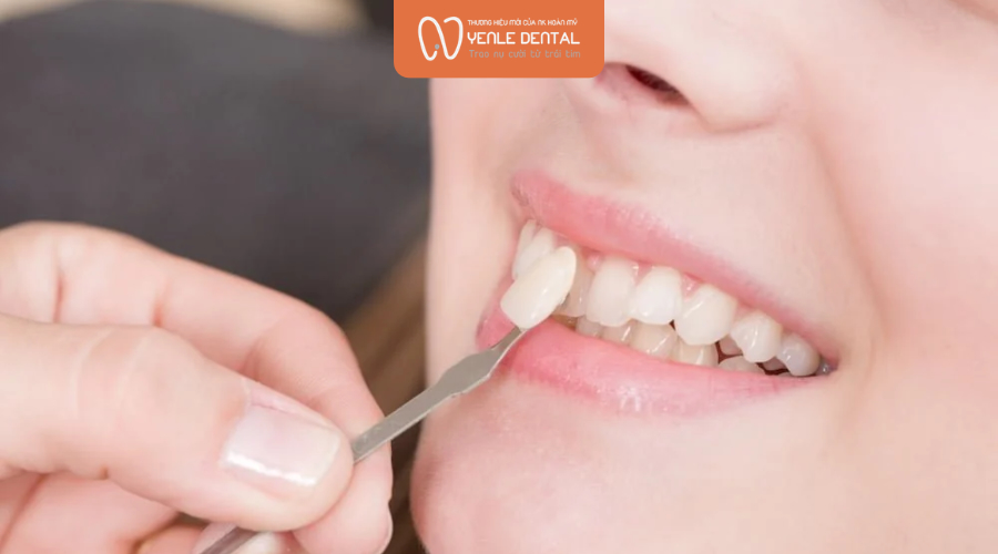 dán răng sứ không phù hợp với tất cả mọi người